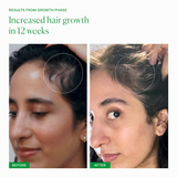 SUPA_THICK SCALP SERUM