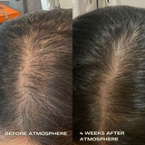 Atmosphere Hair Density & Scalp Serum