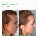 SUPA_THICK SCALP SERUM