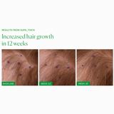 SUPA_THICK SCALP SERUM