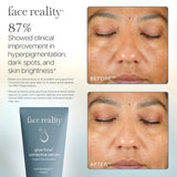 GLOWTONE™ CORRECTIVE SERUM